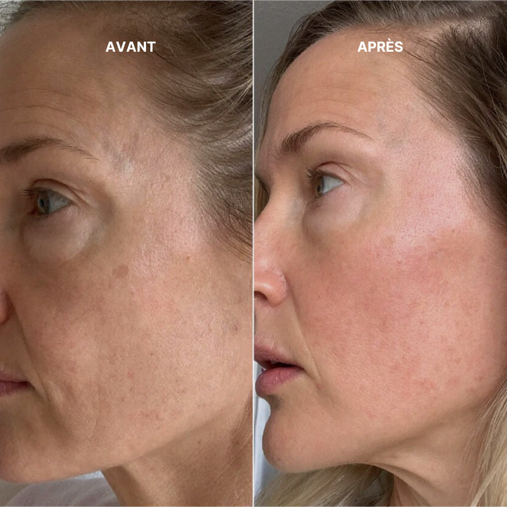 Coffret Prestige HealSelf