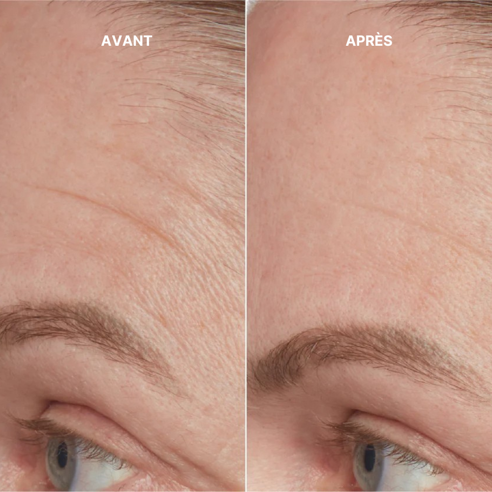 Coffret Prestige HealSelf